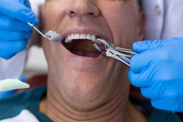 ⚽ World Cup 2026 Smile Deal: Save on Quality Dental Care in Ventura