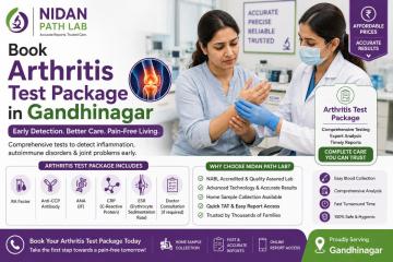 Book Arthritis Test Package in Gandhinagar - Nidan Path Lab