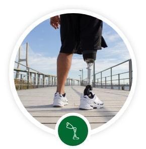 Best Prosthetic and orthotics Clinic in Hyderabad