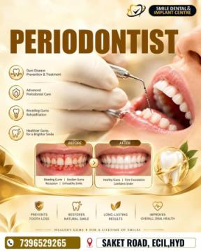Periodontist in AS Rao Nagar | Gum Disease Treatment | Smile Dental and Implant Centre