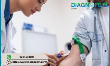 Reliable Home Blood Collection Centre Near Me for Blood Tests