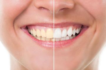 cosmetic dentistry chino hills