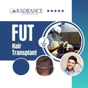 Hair Transplant Doctors In Hyderabad