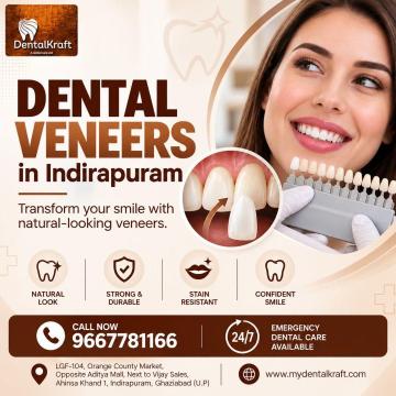 Dental Veneers in Indirapuram: Perfect Smile at Dental Kraft