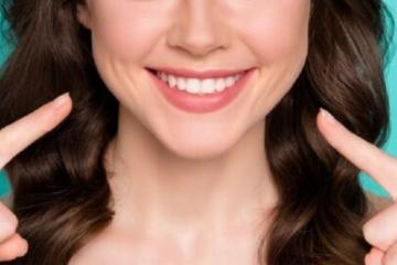 Smile Makeover in Bandra