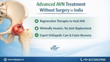 AVN treatment without surgery in India – Hip Xpert