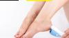 Premium Callus Remover for Smooth, Soft Feet