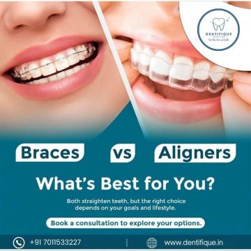Affordable Braces Treatment in New Delhi