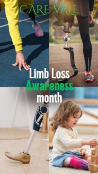 Best Artificial Leg in Hyderabad | CareVale Prosthetics