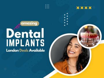 Grab offers and deals on tooth implants solution