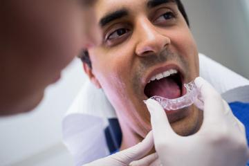 Best Invisalign Treatment | Affordable Invisalign Treatment in Madurai – Zaara Dentistr