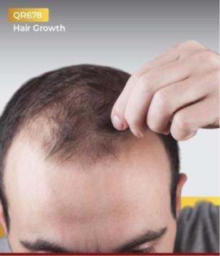 QR678 Hair Treatment in Delhi – Regrow Healthy Hair at Pachouli Wellness