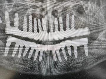 Prime Smile Dental, PC