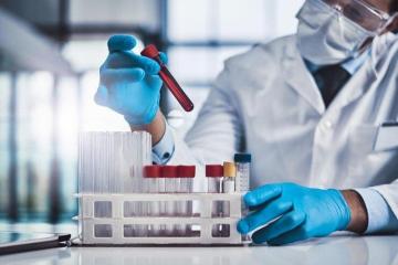 Comprehensive HCP Analysis for Biologics Quality Assessment