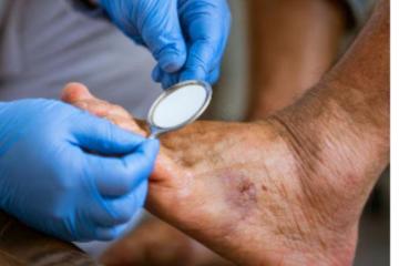 Comprehensive Diabetic Neuropathy Treatment and Support