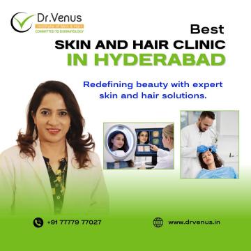 Famous Skin And Hair Clinic In Hyderabad | Dr. Venus