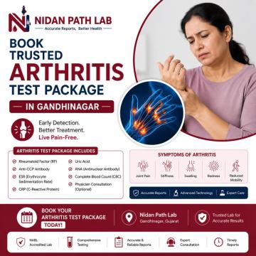 Book Trusted Arthritis Test Package in Gandhinagar at Nidan Path Lab