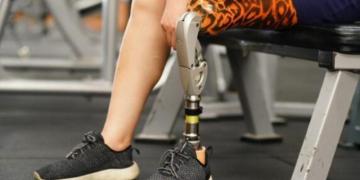 Modern Lightweight Artificial Leg Designed for Daily Comfort