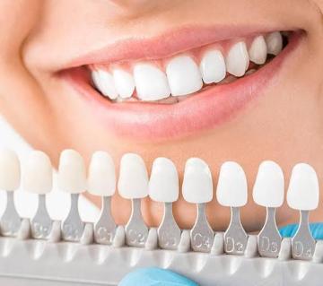 Professional Teeth Whitening & Cosmetic Dentistry in Miami