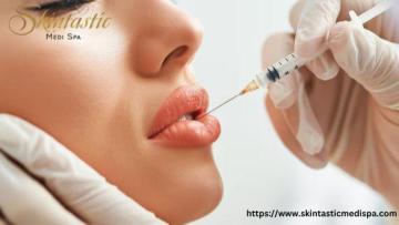 Premium Lip Fillers Riverside with Stunning Results