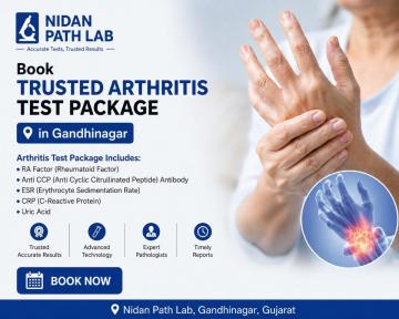 Book Arthritis Profile Test in Gandhinagar at Nidan Path Lab