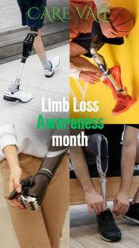 Best Artificial Leg in Hyderabad | CareVale Prosthetics