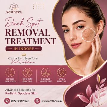 Dark Spot Removal Treatment in Indore - Aestheva