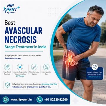 Best Avascular Necrosis Stage Treatment in India – HipXpert