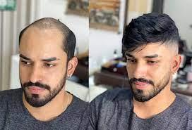 Hairpiece Warehouse for Men's Hair Replacement Solutions