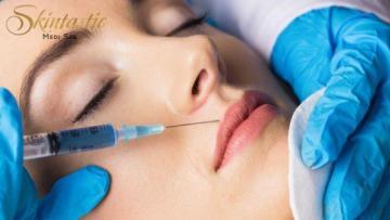 Best Lip Fillers Riverside for Smooth and Plump Lips