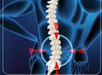 Minimally Invasive Spine Surgery