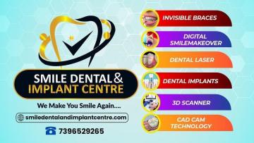 Trusted Dental Clinic in Kapra, ECIL & AS Rao Nagar | Smile Dental and Implant Centre