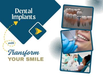 Grab offers and deals on tooth implants solution