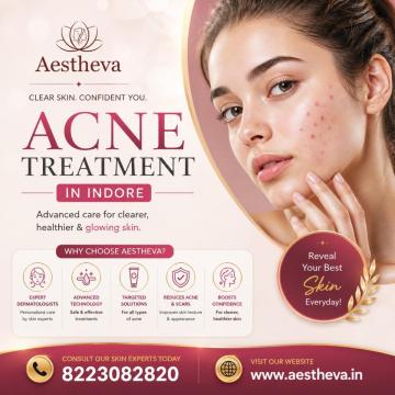 Acne Treatment in Indore - Aestheva