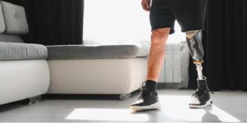 Explore Above Knee Advanced Prosthetic Leg Options with CuraFoot